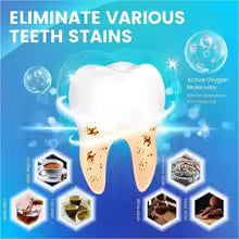 5D Teeth Whitening Strips – Instant Bright & White Smile