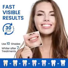 5D Teeth Whitening Strips – Instant Bright & White Smile