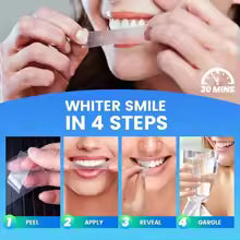 5D Teeth Whitening Strips – Instant Bright & White Smile